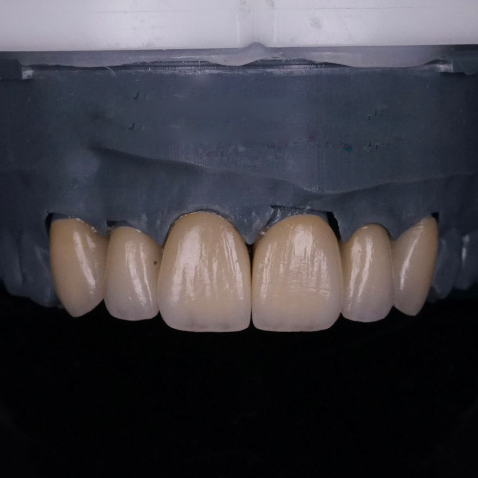 Protetică dentară