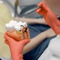 3 semne ascunse că o carie a ajuns la nerv (și cum eviți o extracție de urgență)